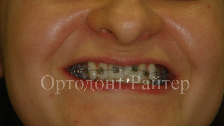 ортодонты и стоматология