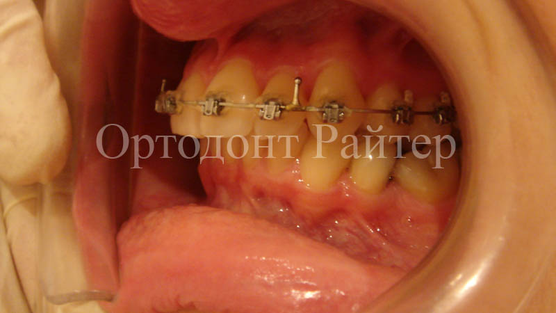 правила ортодонтии