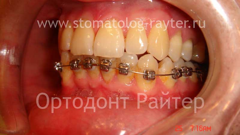 стоматология ортодонтическая