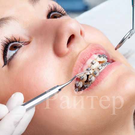 ортодонтическая фиксация