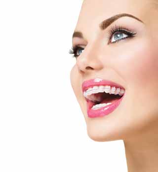 зубные брекеты в ортодонтии